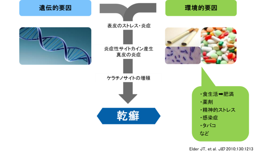 乾癬の原因のイメージ画像